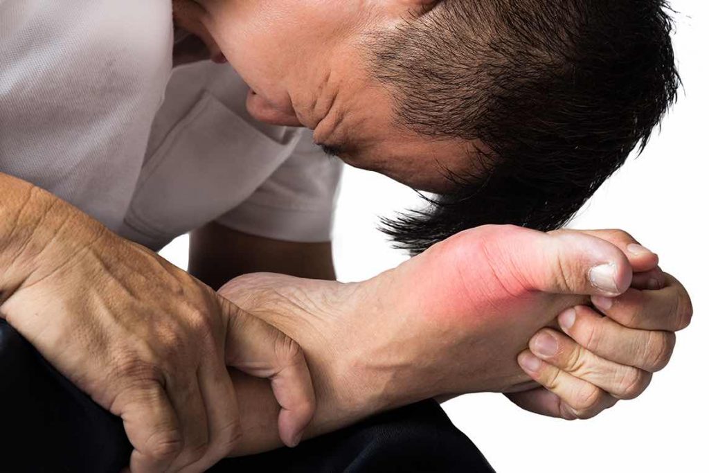 Gout là căn bệnh gây đau đớn bậc nhất, nhận biết sớm qua dấu hiệu của bệnh gout