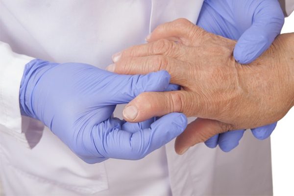 Bệnh gout gây đau nhức và buốt ở ngón tay