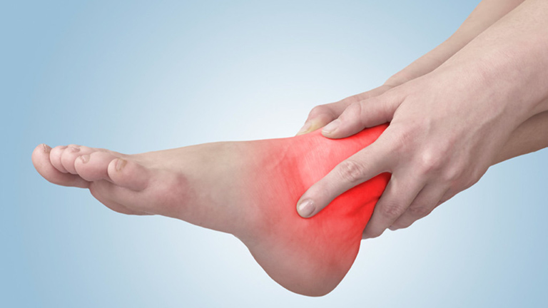 Thoái hóa khớp chân là tình trạng xương khớp bị tổn thương gây đau nhức, sưng viêm