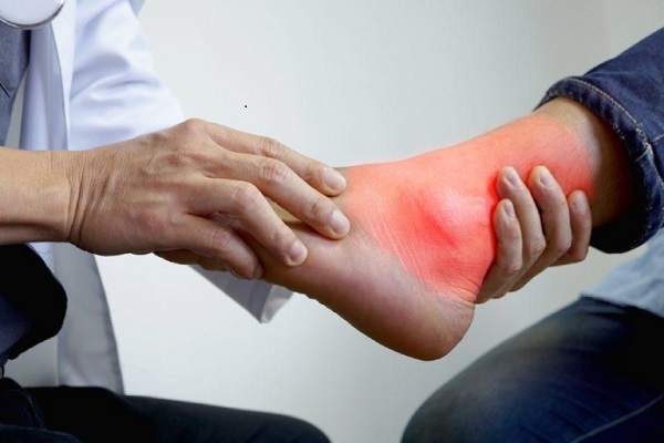 Tràn dịch khớp cổ chân phải làm sao? Cách chữa chuyên gia chia sẻ