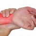 Viêm khớp cổ tay có thể gặp ở mọi lứa tuổi